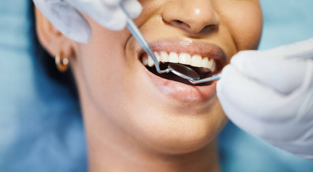 Best Emergency Care for Gum Disease in Kyle, SD